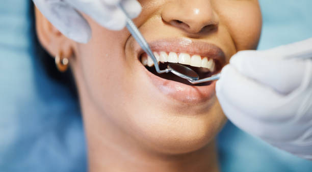 Best Emergency Dental Services for Seniors in Lake Junaluska, NC