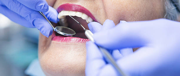 Best Broken or Cracked Tooth Emergency Dentist in Lake Junaluska, NC